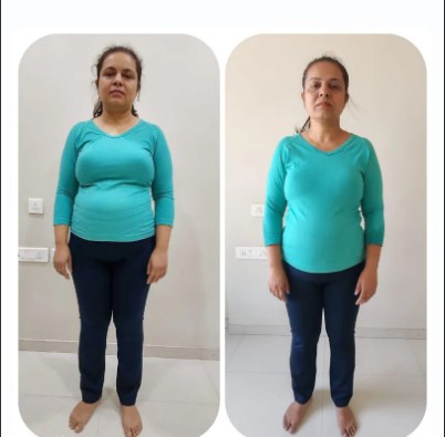 Priti Chheda — Before